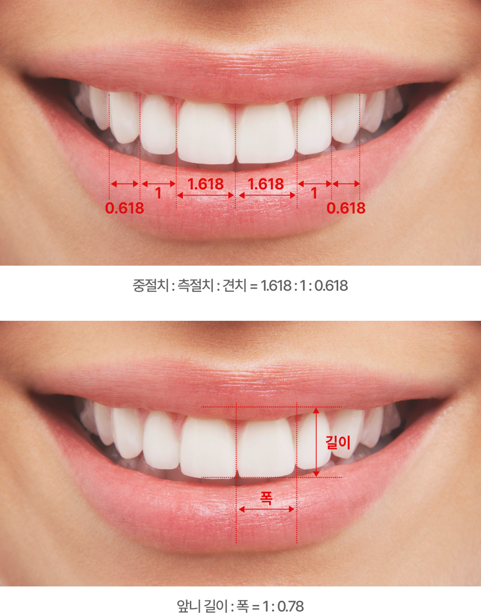 중절치 : 측절치 : 견치 = 1.618 : 1 : 0.618, 앞니 길이 : 폭 = 1 : 0.78